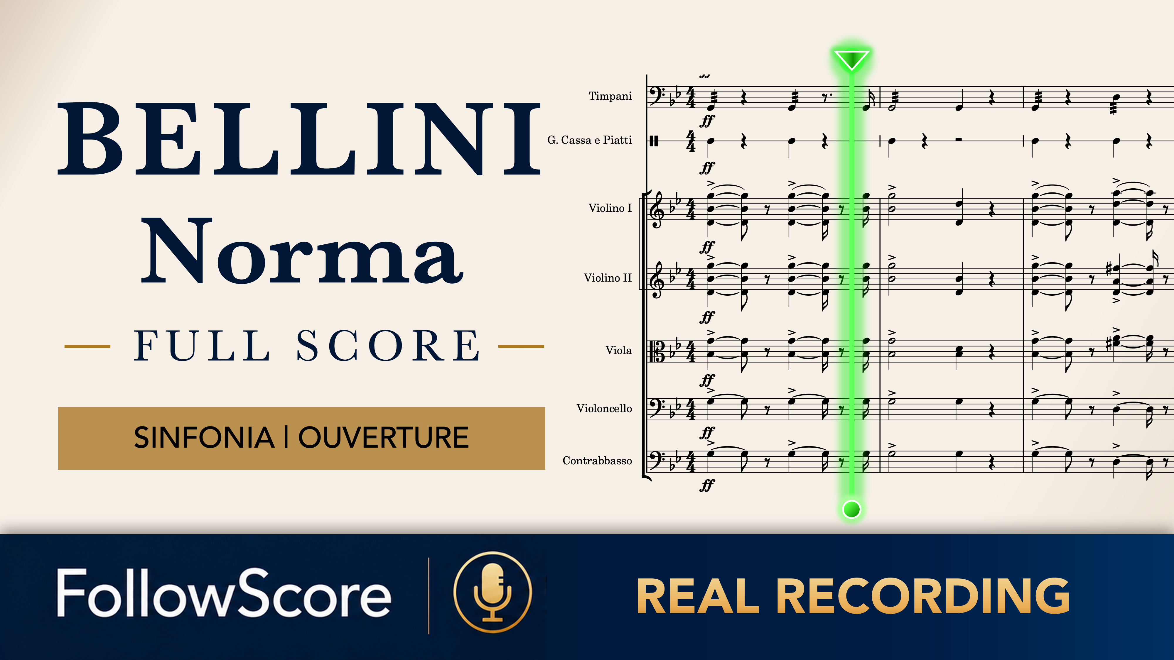 Norma: Sinfonia (Overture) — Complete Overture